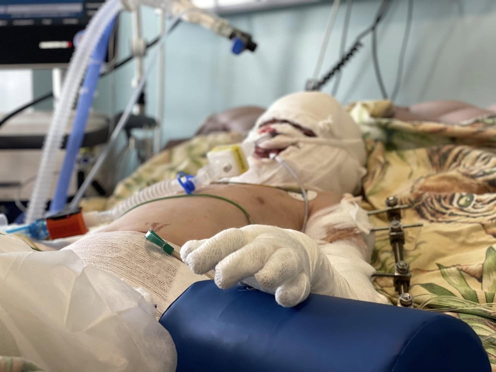 https://44542412.fs1.hubspotusercontent-na1.net/hubfs/44542412/Roman-in-hospital.jpg